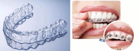 2022年成都十大牙齿矫正医院排名，成都牙齿矫正哪里性价比最高？成都牙齿矫正价格表！(图11)