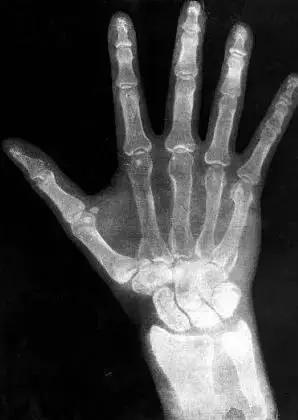 世界科学史十大“最意外发明”(图3)